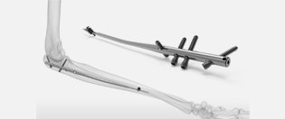 NAILING SYSTEM